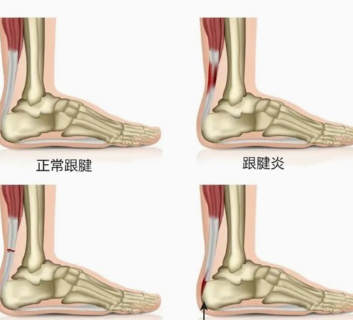 跟队：阿森纳薪资预算远超纽卡，后者想留吉马良斯越发困难